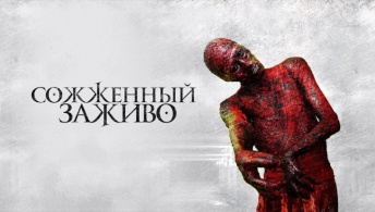 Сожженный заживо